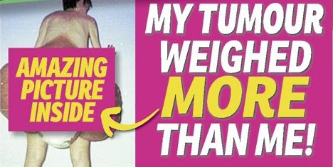 take 5 tumour