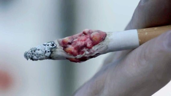 NSW revives ‘shocking’ 13-year-old UK campaign for new anti-tobacco push